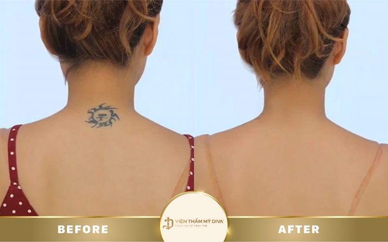 Hình Xăm Hài Hước: Khám Phá Thế Giới Nghệ Thuật Xăm Đầy Tiếng Cười