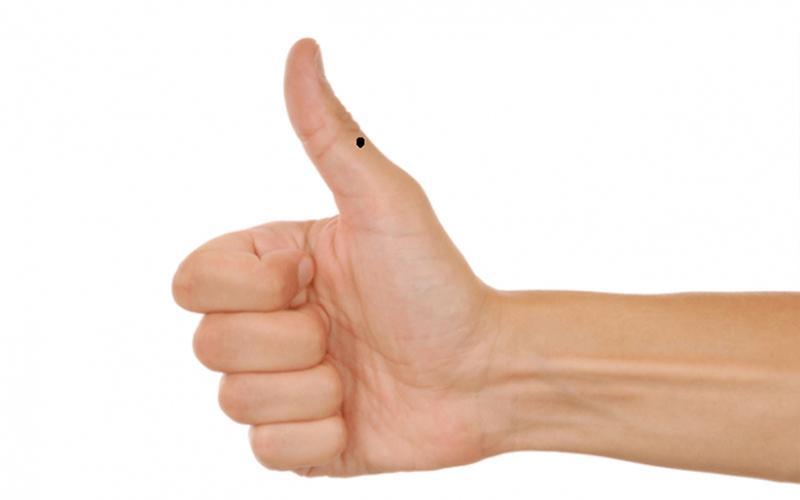 Giải mã ý nghĩa của nốt ruồi ở ngón tay