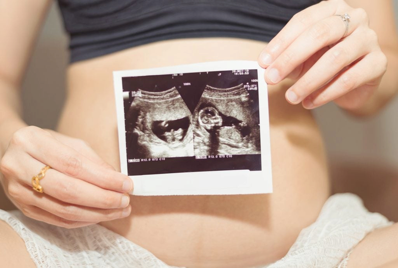 Dự đoán giới tính con yêu dựa trên hình ảnh bụng bầu qua từng tháng liệu có đúng?