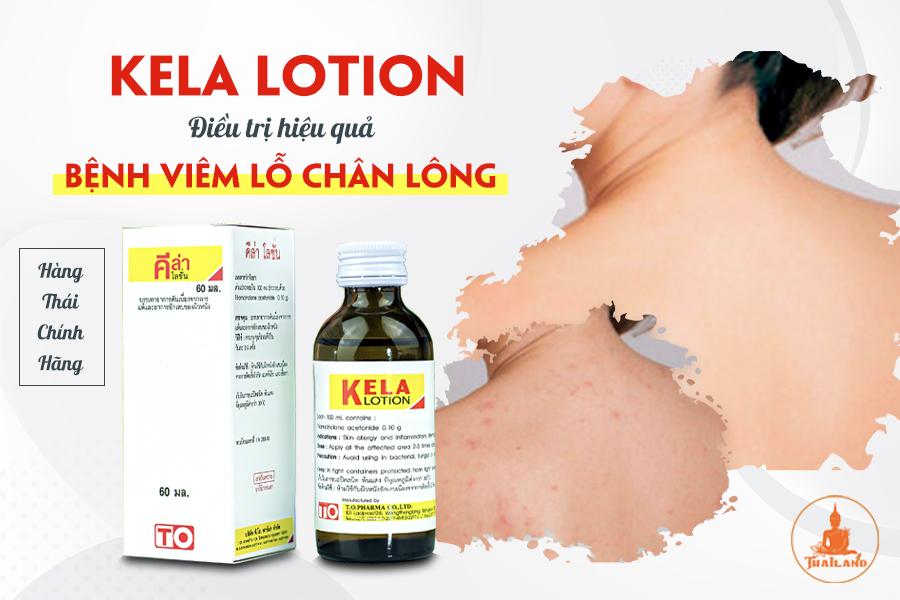 Kem đặc trị viêm lỗ chân lông Kela Lotion 60ml