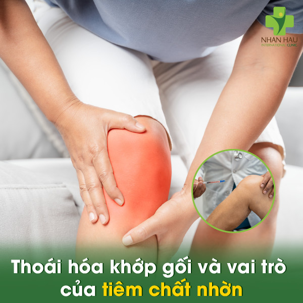 Tiêm chất nhờn vào khớp gối giá bao nhiêu? Nơi uy tín để tiêm chất nhờn vào khớp gối