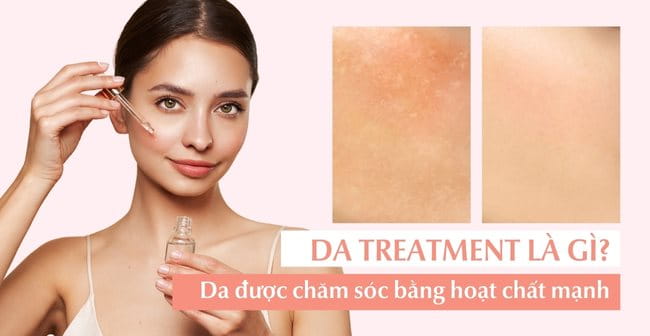 Treatment là gì trong mỹ phẩm? Các loại treatment phổ biến hiện nay