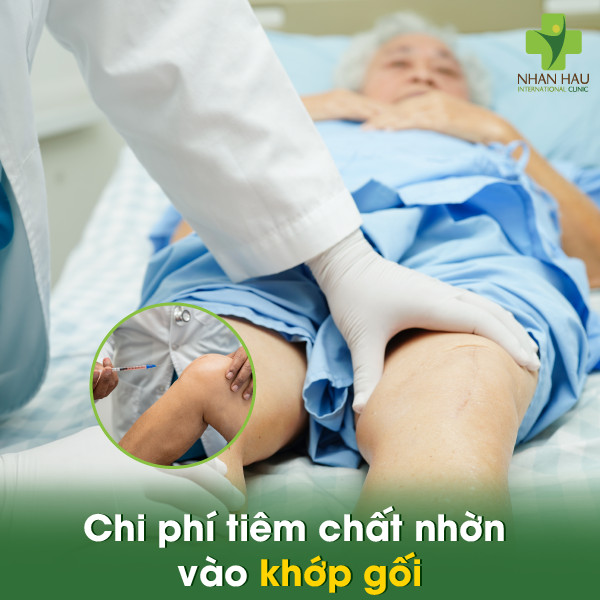 Tiêm chất nhờn vào khớp gối giá bao nhiêu? Nơi uy tín để tiêm chất nhờn vào khớp gối